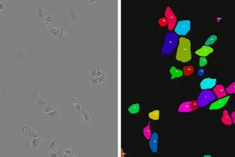 Die Zellen werden von einer Künstlichen Intelligenz vollautomatisch identifiziert.