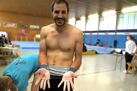 Dominik Scherer vom tV Lemberg zeigt seine lädierten Hände nach der Übung am Hochreck. Aber Aufhören war keine Option für den Ac