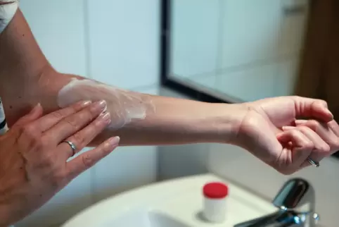 Frau cremt Arm mit einer Salbe ein